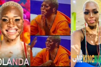 "I Wasn't Born With Vitiligo"- BBMzanzi Yolanda Says, Reveals How It H@ppened (VIDEO)